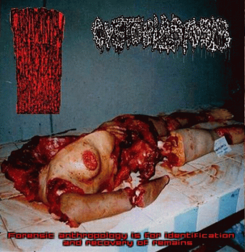 Cystoblastosis : Forensic Anthropology Is for Identification and Recovery of Remains